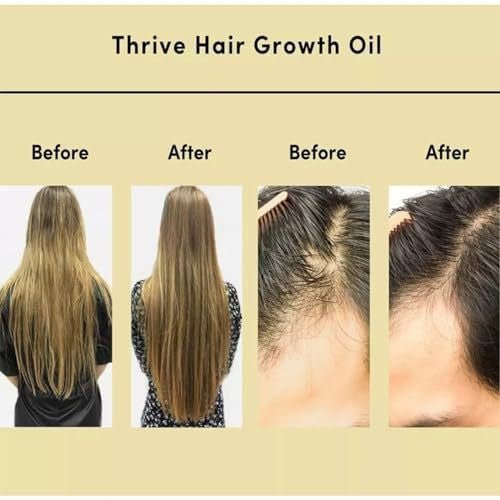 Vegan Rosemary Hair Growth Essential Oil - BrandedPieces' shop