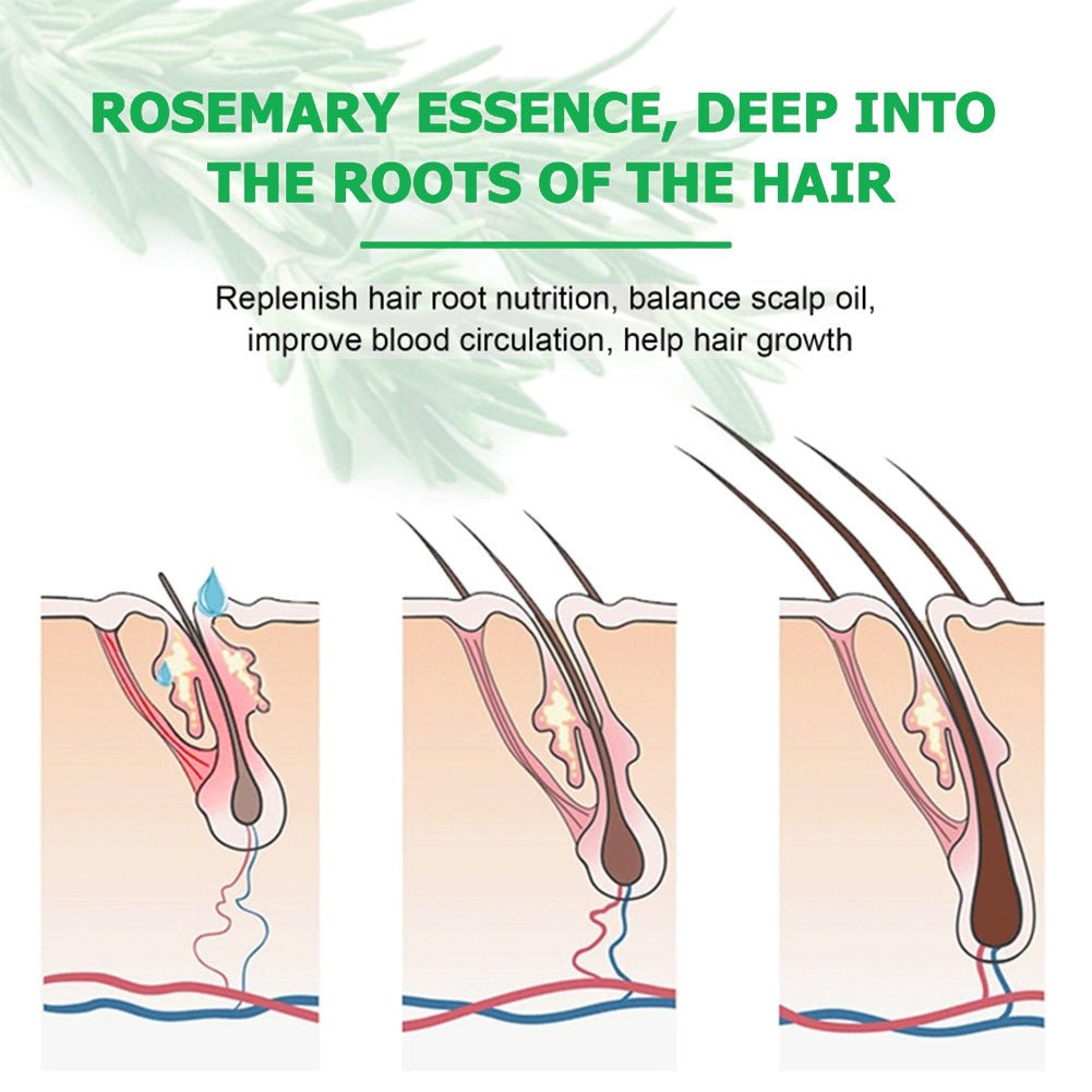 Rosemary Hair Growth Scalp Treatment Oil - BrandedPieces' shop