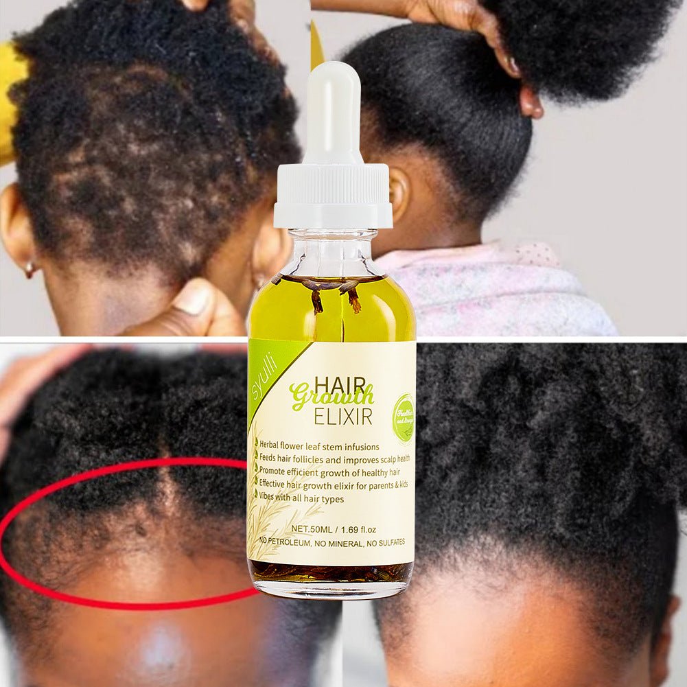 Rosemary Hair Growth Scalp Treatment Oil - BrandedPieces' shop