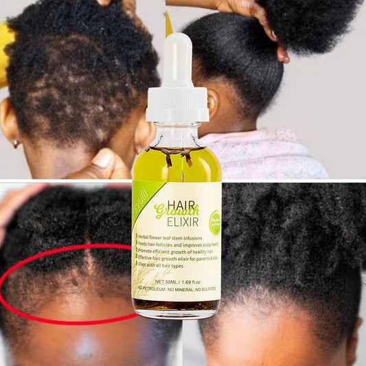 Rosemary Hair Growth Scalp Treatment Oil - BrandedPieces' shop