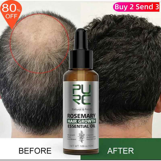 Rosemary Oil Hair Growth Products Ginger Anti Loss Fast - BrandedPieces' shop