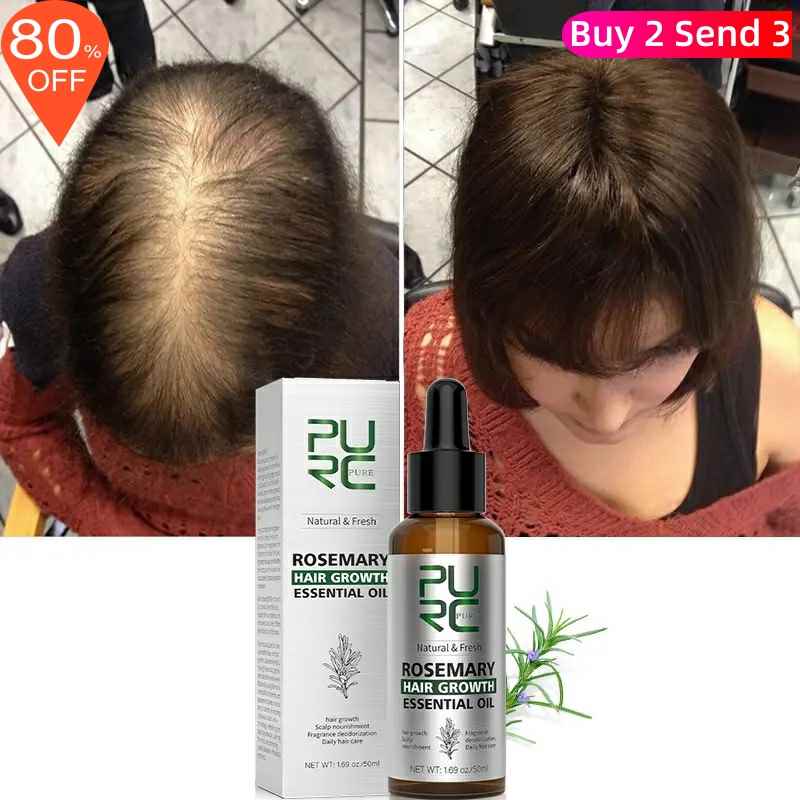 Rosemary Oil Hair Growth Products Ginger Anti Loss Fast - BrandedPieces' shop