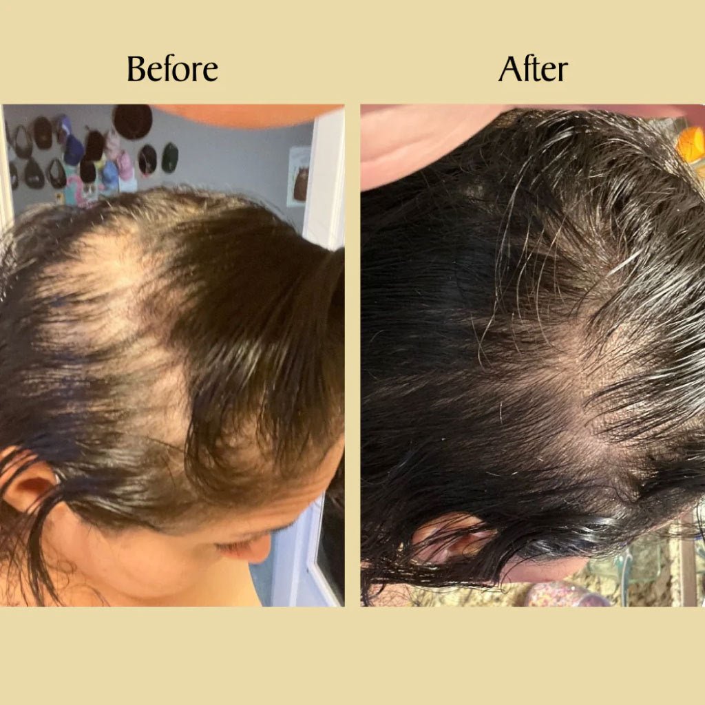 Vegan Rosemary Hair Growth Essential Oil - BrandedPieces' shop