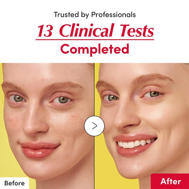 Vitamin Brightening Essence Facial Serum - BrandedPieces' shop